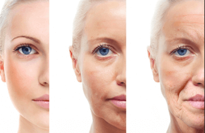 טיפול נגד הזדקנות העור